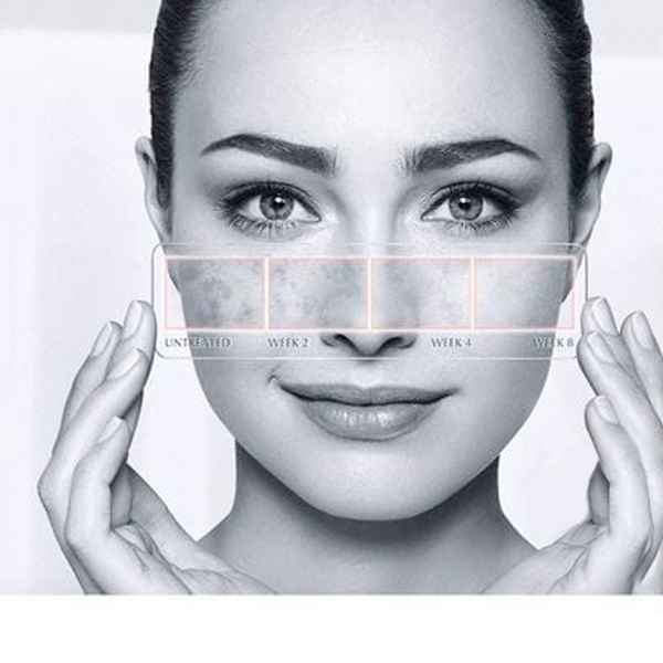 Eucerin Anti-Pigment