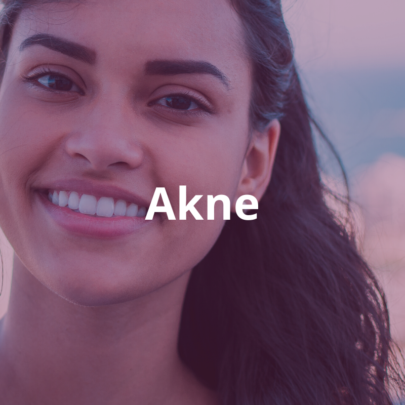 Tuoteryhmä: Rasvoittuva tai epäpuhdas iho