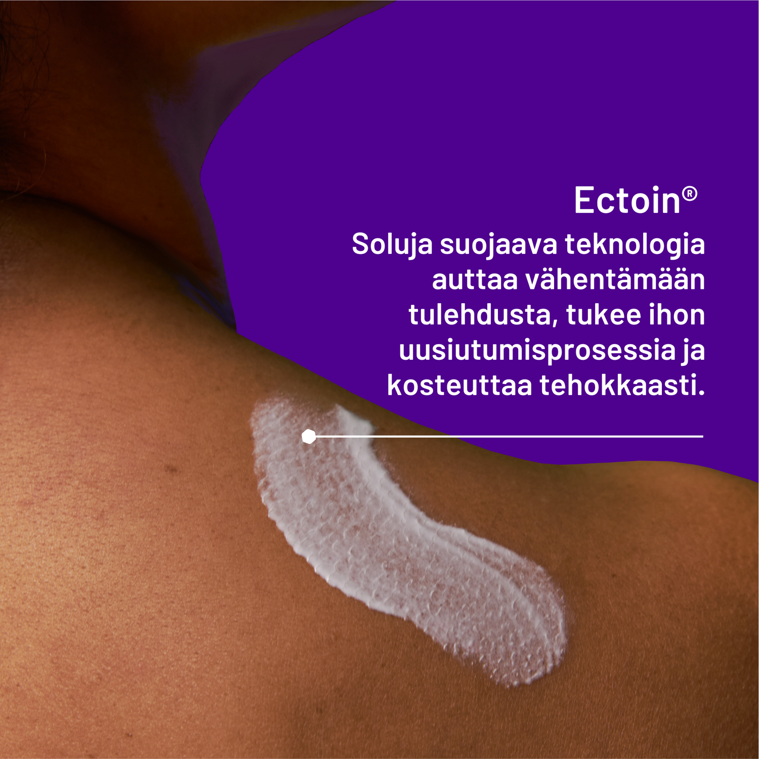 Locobase Psoriasis Cream 50 ml - Apteekkiplus.fi