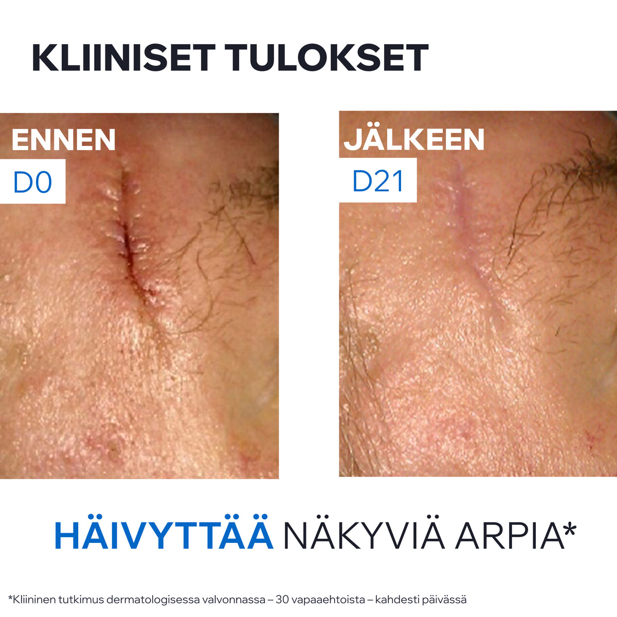 Uriage Bariederm Cica Cream with Copper-Zinc