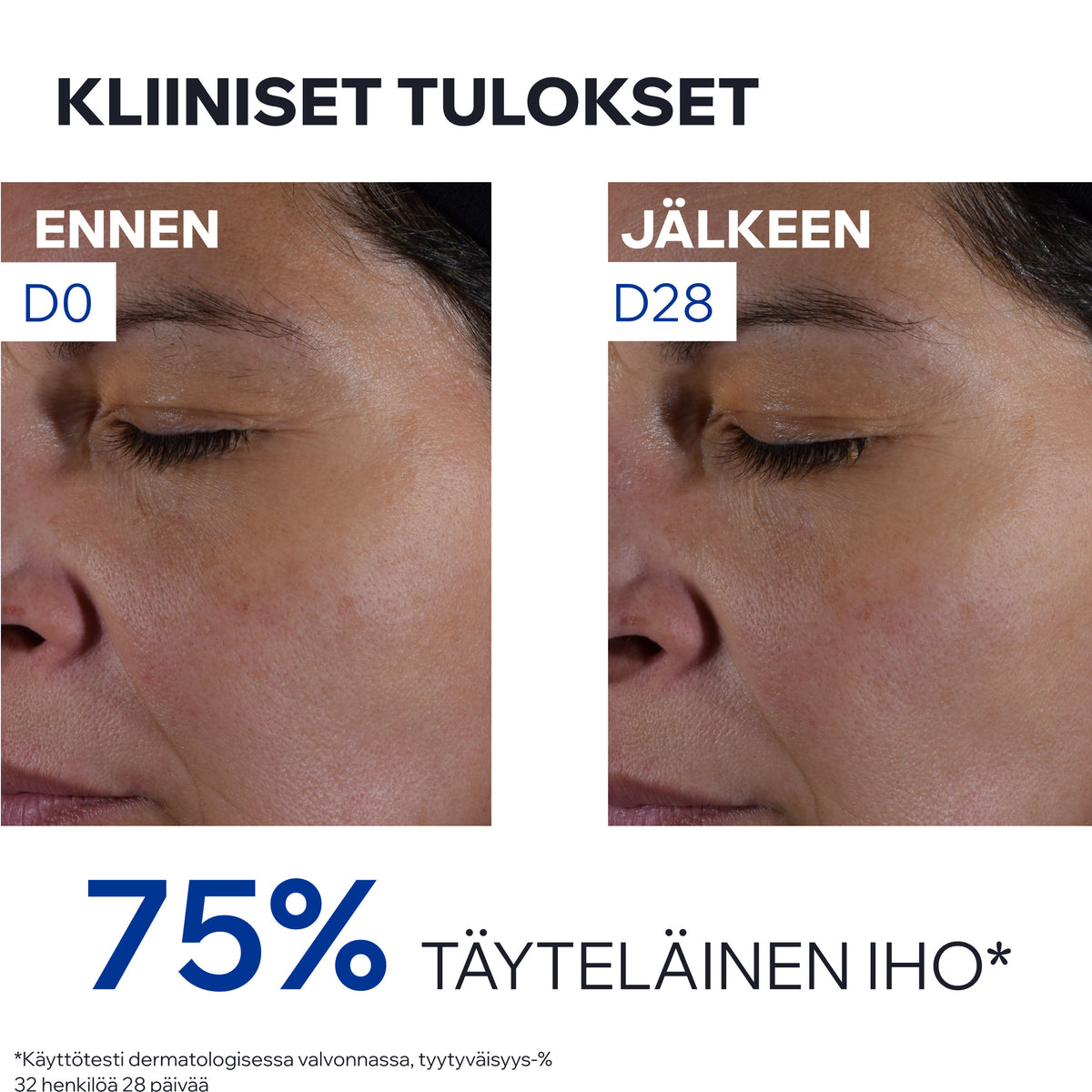 Uriage Age Absolu Redensifying Rosy Cream heleyttävä päivävoide 50ml