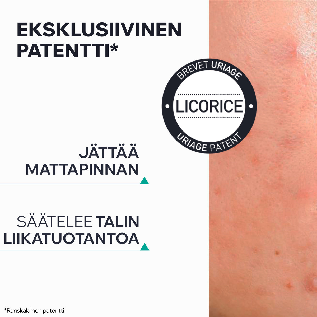 Uriage Hyseac 3-Regul+ Anti-Blemish Global Care
