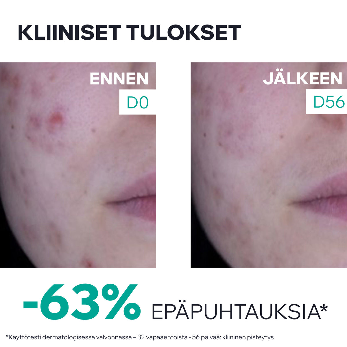 Uriage Hyseac 3-Regul+ Anti-Blemish Global Care