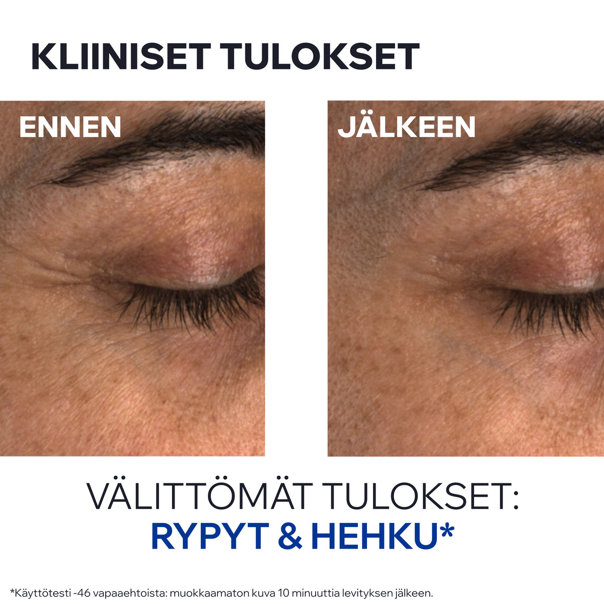 Uriage Age Absolu Blur-Redensifying Eye Balm kiinteyttävä silmänympärysvoide 15ml
