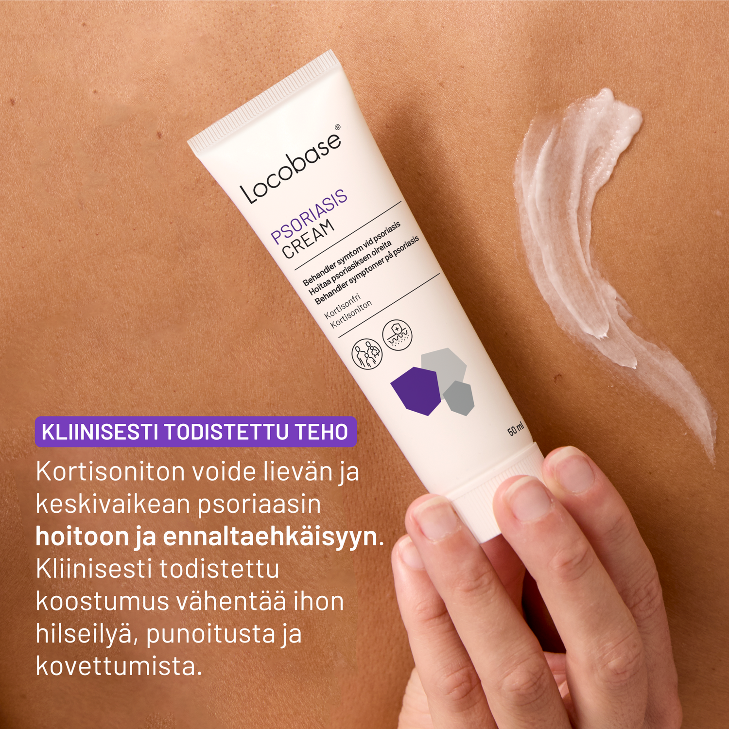 Locobase Psoriasis Cream 50 ml - Apteekkiplus.fi
