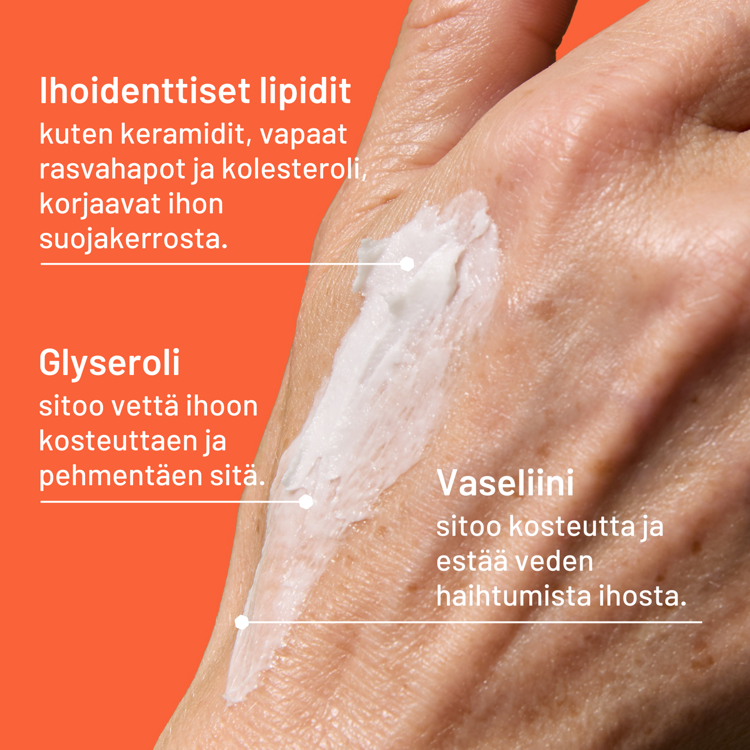 Locobase Repair erikoisvoide - eri kokoja - Apteekkiplus.fi